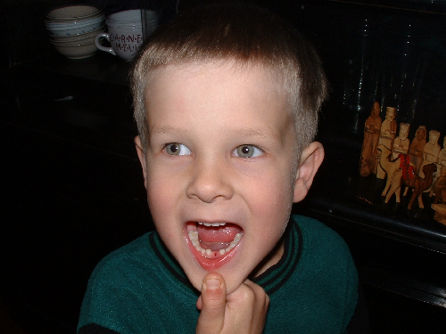 2009-12-11_21:04:05_jonathan_first_lost_tooth.jpg, 692 KB