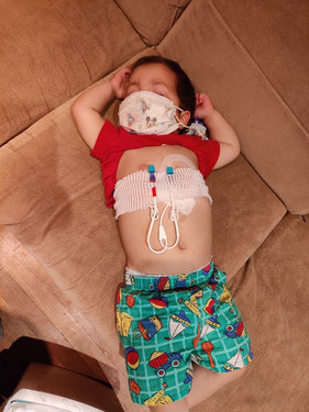 2024-09-30_21:00:00_grace-sleeping-during-dressing-change.jpg, 131 KB