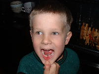 Jonathan's first missing tooth.
